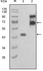 Fibulin 2 Monoclonal Antibody (7H4F6/3B9A11)