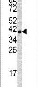Fibrillarin Antibody in Western Blot (WB)