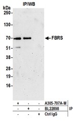 FBRS Antibody in Immunoprecipitation (IP)