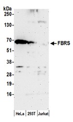 FBRS Polyclonal Antibody