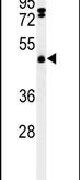 FBXL2 Antibody in Western Blot (WB)