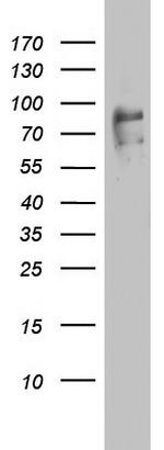 FBXO11 Antibody in Western Blot (WB)