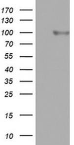 FBXO11 Antibody in Western Blot (WB)