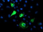 FBXO21 Antibody in Immunocytochemistry (ICC/IF)
