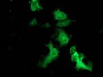 FBXO21 Antibody in Immunocytochemistry (ICC/IF)