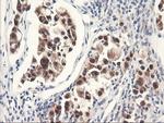 FBXO21 Antibody in Immunohistochemistry (Paraffin) (IHC (P))