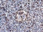 FBXO21 Antibody in Immunohistochemistry (Paraffin) (IHC (P))