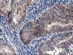 FBXO21 Antibody in Immunohistochemistry (Paraffin) (IHC (P))