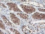 FBXO21 Antibody in Immunohistochemistry (Paraffin) (IHC (P))
