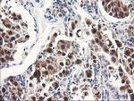 FBXO21 Antibody in Immunohistochemistry (Paraffin) (IHC (P))