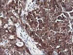 FBXO21 Antibody in Immunohistochemistry (Paraffin) (IHC (P))