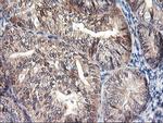 FBXO21 Antibody in Immunohistochemistry (Paraffin) (IHC (P))