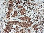 FBXO21 Antibody in Immunohistochemistry (Paraffin) (IHC (P))