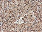 FBXO21 Antibody in Immunohistochemistry (Paraffin) (IHC (P))