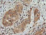 FBXO21 Antibody in Immunohistochemistry (Paraffin) (IHC (P))