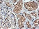 FBXO21 Antibody in Immunohistochemistry (Paraffin) (IHC (P))