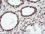 FBXO21 Antibody in Immunohistochemistry (Paraffin) (IHC (P))