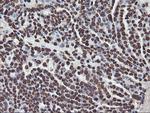 FBXO21 Antibody in Immunohistochemistry (Paraffin) (IHC (P))
