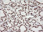 FBXO21 Antibody in Immunohistochemistry (Paraffin) (IHC (P))