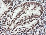 FBXO21 Antibody in Immunohistochemistry (Paraffin) (IHC (P))