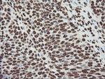 FBXO21 Antibody in Immunohistochemistry (Paraffin) (IHC (P))