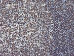 FBXO21 Antibody in Immunohistochemistry (Paraffin) (IHC (P))
