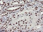 FBXO21 Antibody in Immunohistochemistry (Paraffin) (IHC (P))
