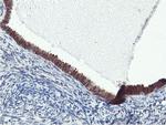 FBXO21 Antibody in Immunohistochemistry (Paraffin) (IHC (P))