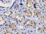 FBXO21 Antibody in Immunohistochemistry (Paraffin) (IHC (P))