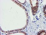 FBXO21 Antibody in Immunohistochemistry (Paraffin) (IHC (P))