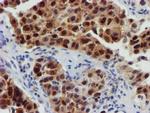 FBXO21 Antibody in Immunohistochemistry (Paraffin) (IHC (P))