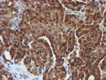 FBXO21 Antibody in Immunohistochemistry (Paraffin) (IHC (P))