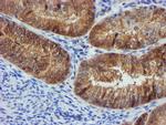 FBXO21 Antibody in Immunohistochemistry (Paraffin) (IHC (P))