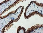 FBXO21 Antibody in Immunohistochemistry (Paraffin) (IHC (P))