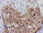 FBXO21 Antibody in Immunohistochemistry (Paraffin) (IHC (P))