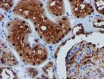 FBXO21 Antibody in Immunohistochemistry (Paraffin) (IHC (P))