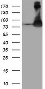 FBXO21 Antibody in Western Blot (WB)