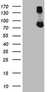 FBXO21 Antibody in Western Blot (WB)