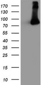 FBXO21 Antibody in Western Blot (WB)