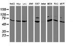 FBXO21 Antibody in Western Blot (WB)