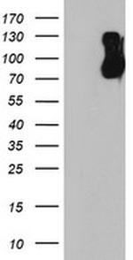 FBXO21 Antibody in Western Blot (WB)