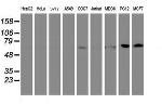 FBXO21 Antibody in Western Blot (WB)