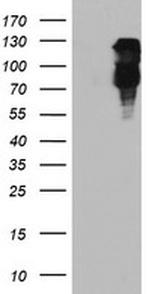 FBXO21 Antibody in Western Blot (WB)