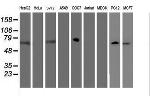FBXO21 Antibody in Western Blot (WB)
