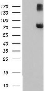 FBXO21 Antibody in Western Blot (WB)