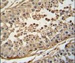 FBXO24 Antibody in Immunohistochemistry (IHC)