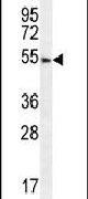 FBXO24 Antibody in Western Blot (WB)
