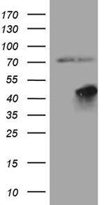 FBXO25 Antibody in Western Blot (WB)