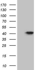 FBXO25 Antibody in Western Blot (WB)