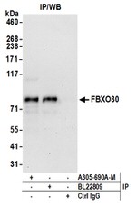 FBXO30 Polyclonal Antibody